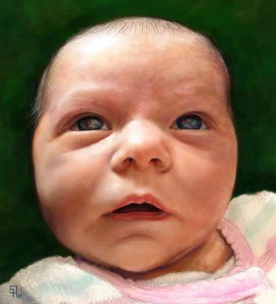 baby bryn